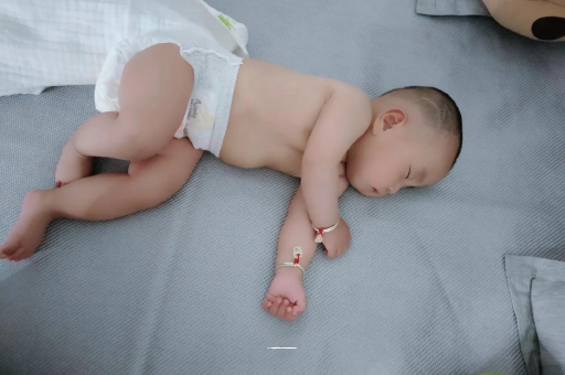 湖北六个月宝宝眼睛散光